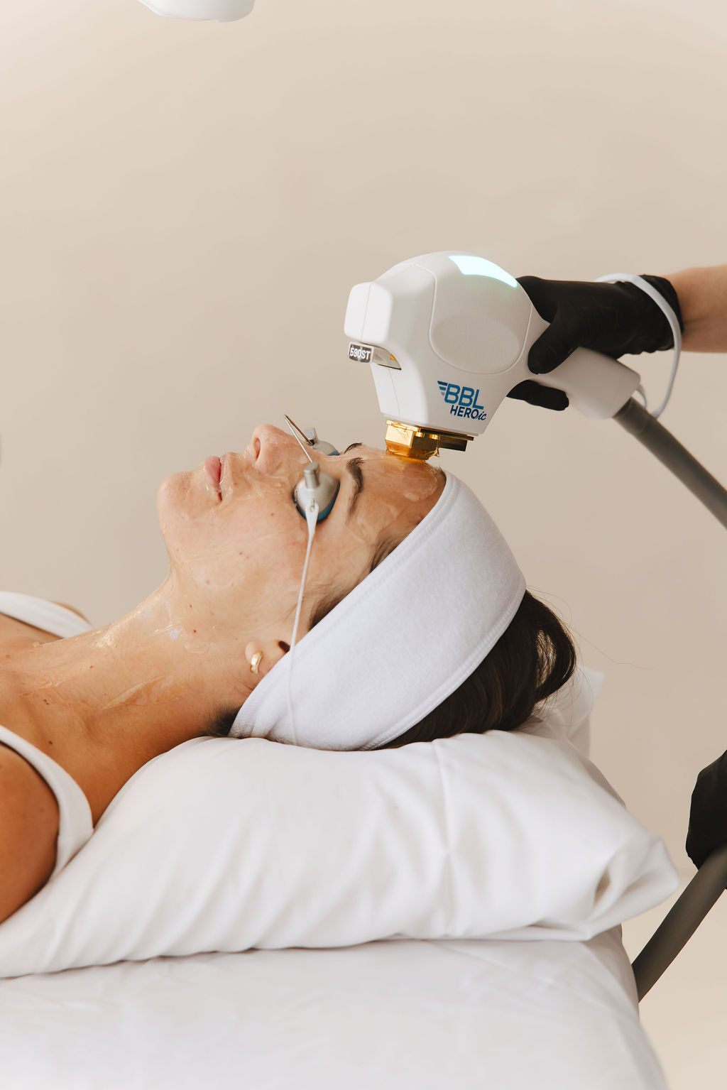 Natalia treats a patient's forehead with BBL HEROic broadband light; the patient wears protective eye shields