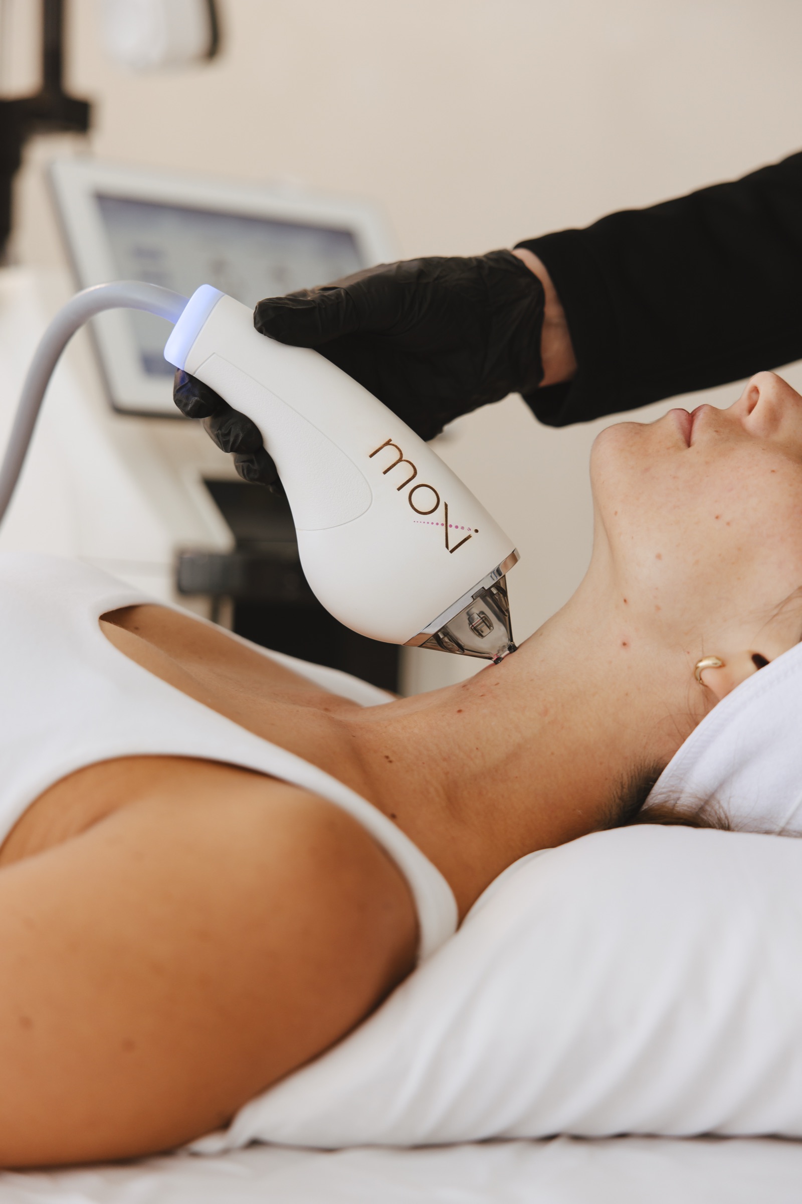 Natalia guides the MOXI fractionated laser over a patient's cheek and jawline